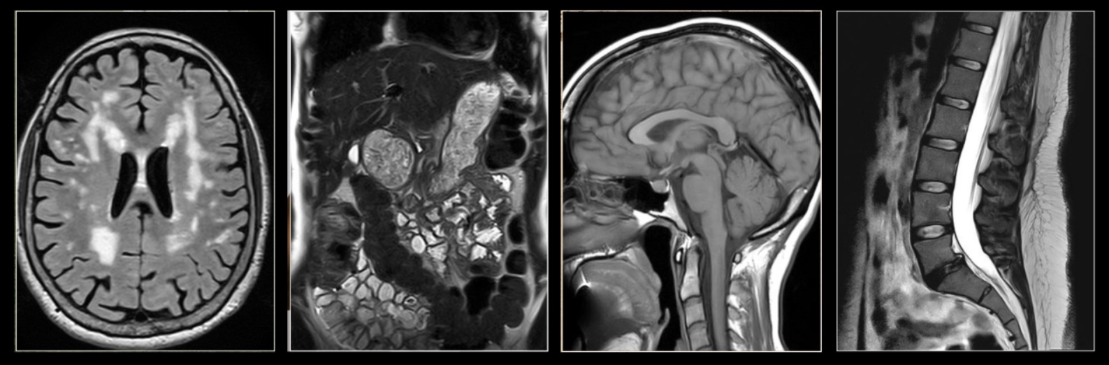 Diagnostic MRI services in Reno, NV